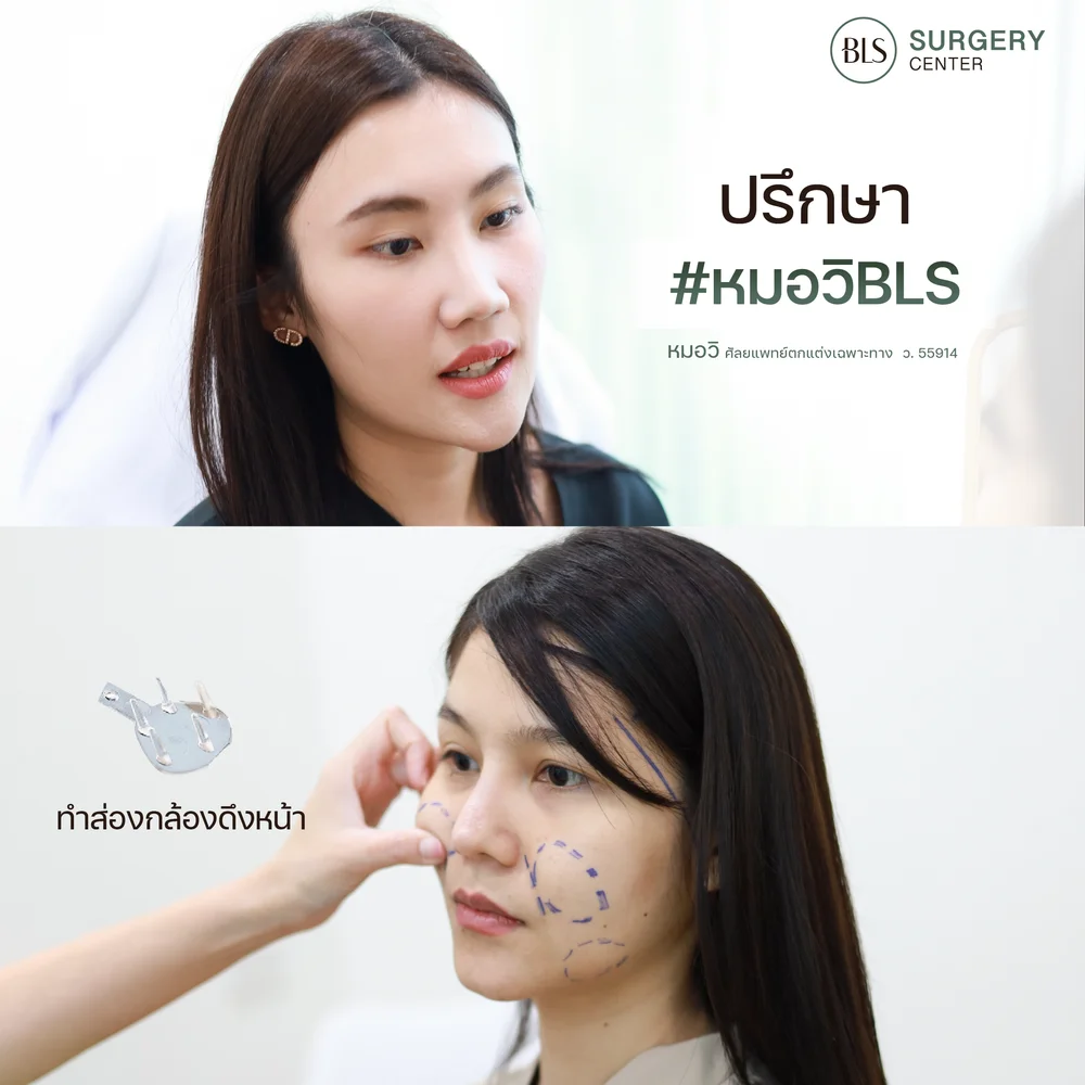 ดึงหน้าโดยศัลยแพทย์เฉพาะทาง