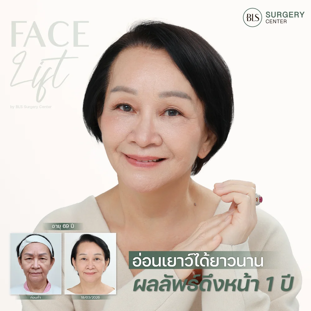 ดึงหน้า 1 ปีเป็นอย่างไร