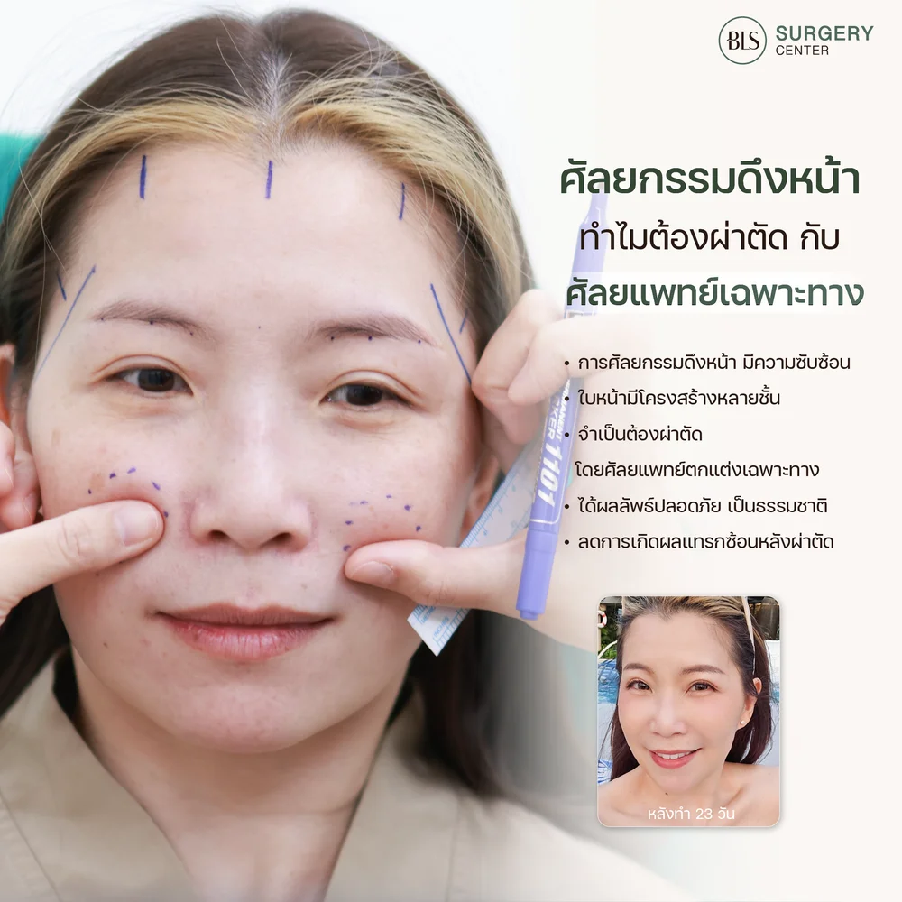 ศัลยกรรมดึงหน้าควรทำกับแพทย์เฉพาะทางหรือไม่