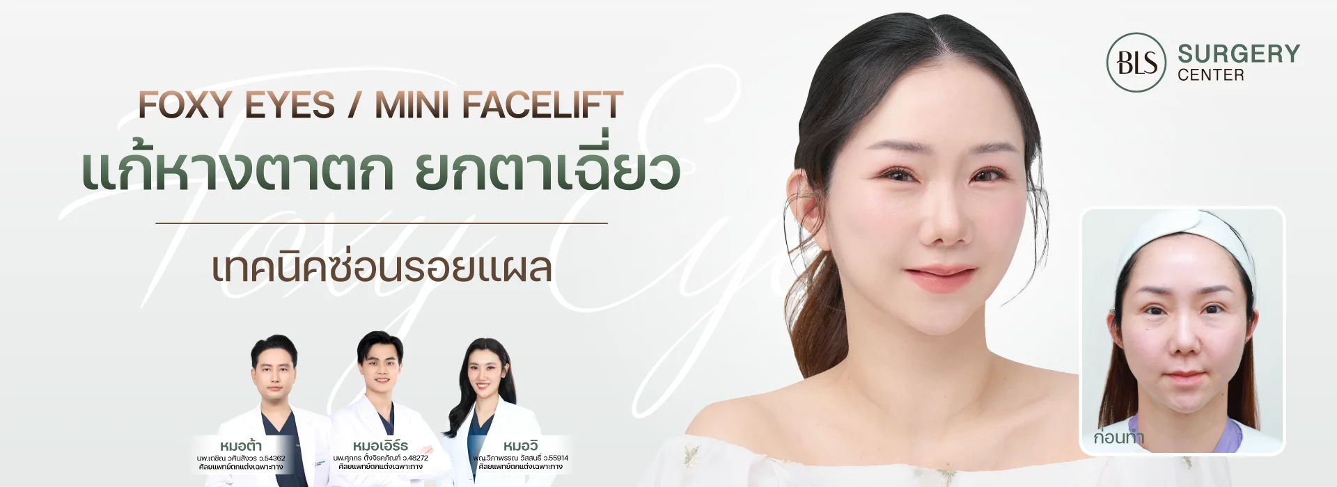 Foxy Eyes แก้หางตาตก ยกหางตาเฉี่ยว