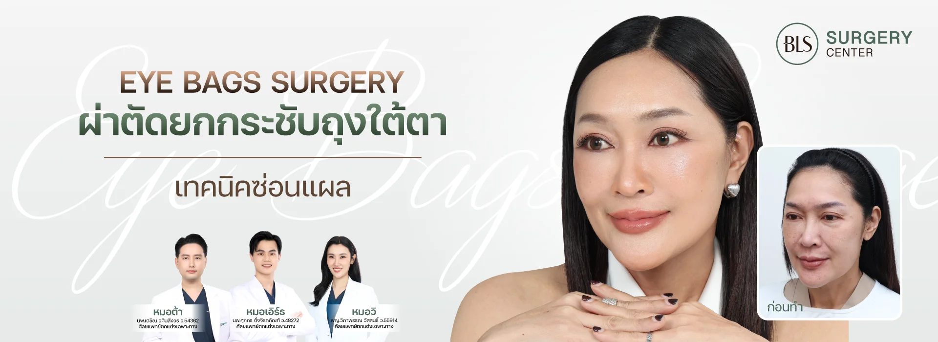 ตัดถุงใต้ตา แก้ใต้ตาบวม (Eye Bags Surgery)