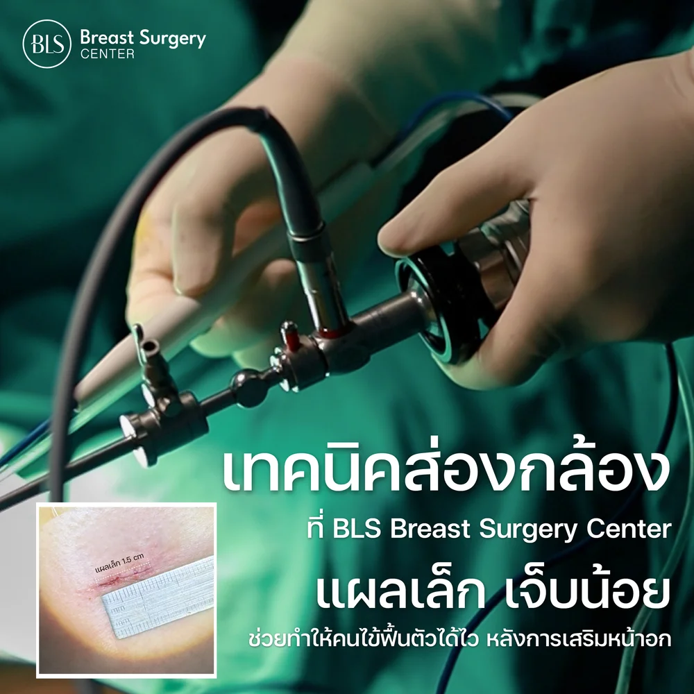 การเสริมหน้าอกด้วยเทคนิคส่องกล้อง Endoscopic Breast Augmentation ที่ BLS