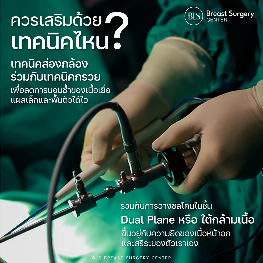 เทคนิคส่องกล้องเสริมหน้าอก Endoscopic Breast ใช้กล้องช่วยมองเห็นภายในชัดเจน