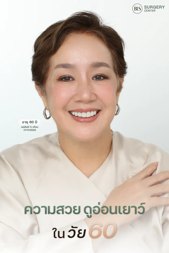 รีวิวดึงหน้าดึงคอ ช่วยยกกระชับใบหน้า ลดความหย่อนคล้อย และปรับกรอบหน้าให้ชัดขึ้น