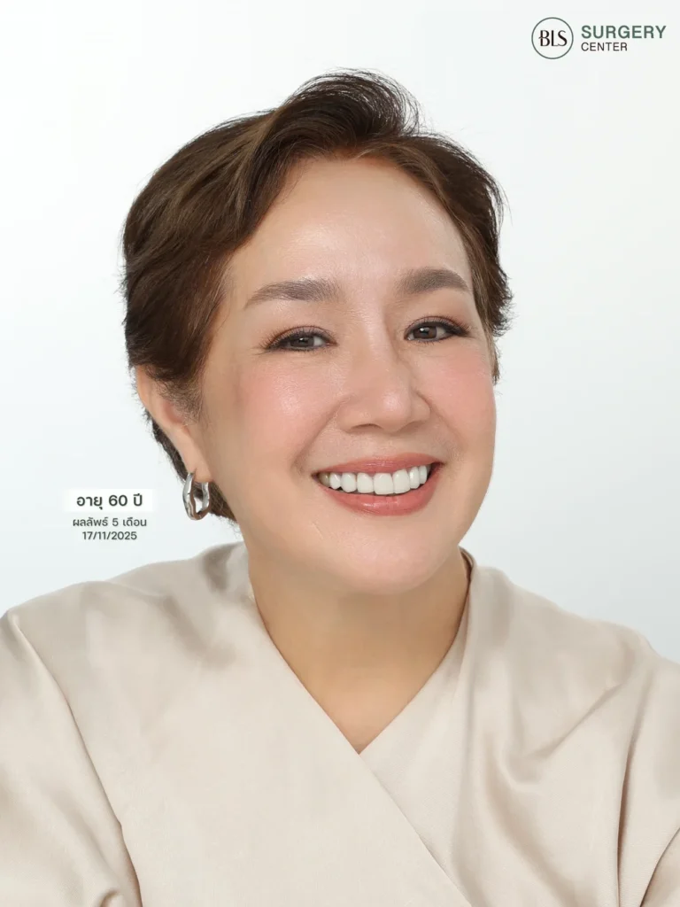 รีวิวดึงหน้าดึงคอ ช่วยยกกระชับใบหน้า ลดความหย่อนคล้อย และปรับกรอบหน้าให้ชัดขึ้น