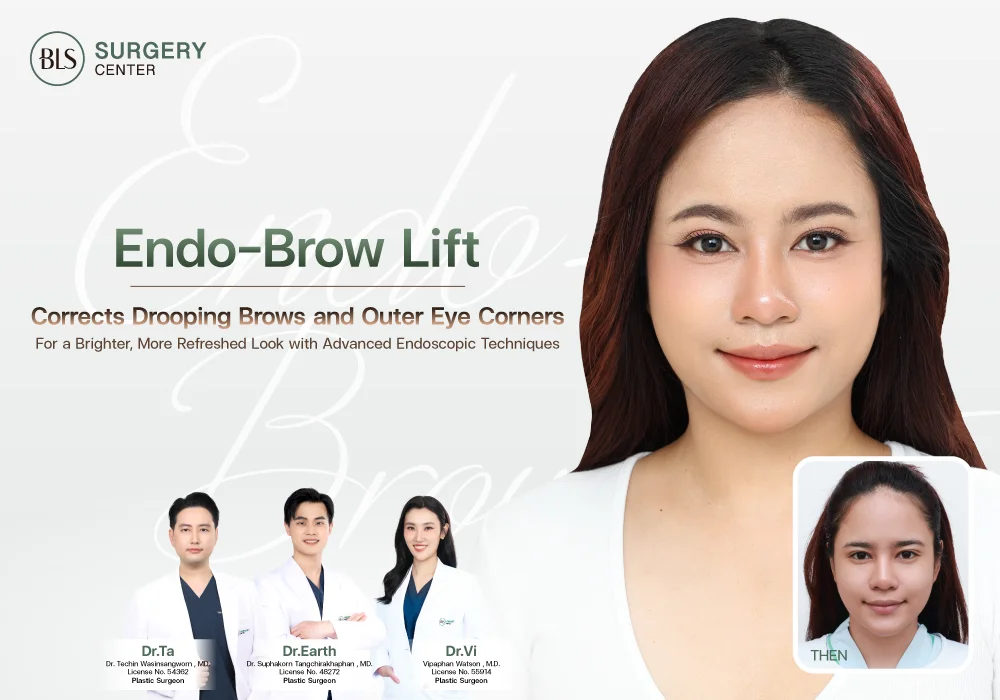 แก้คิ้วตก ตาตก ส่องกล้องยกคิ้ว Endobrow Lift