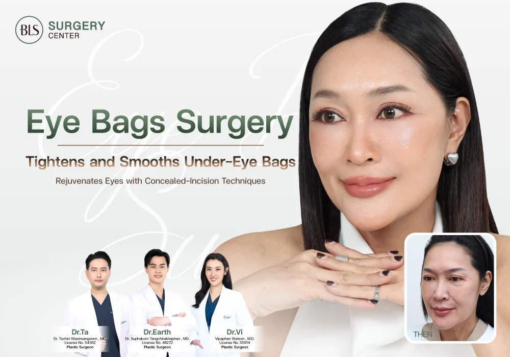 ตัดถุงใต้ตา แก้ใต้ตาบวม (Eye Bags Surgery)