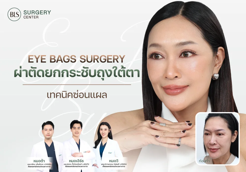 ตัดถุงใต้ตา แก้ใต้ตาบวม (Eye Bags Surgery)