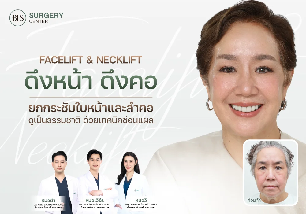 ดึงหน้า ดึงคอ (Facelift & Necklift) ยกกระชับหน้าและลำคอ