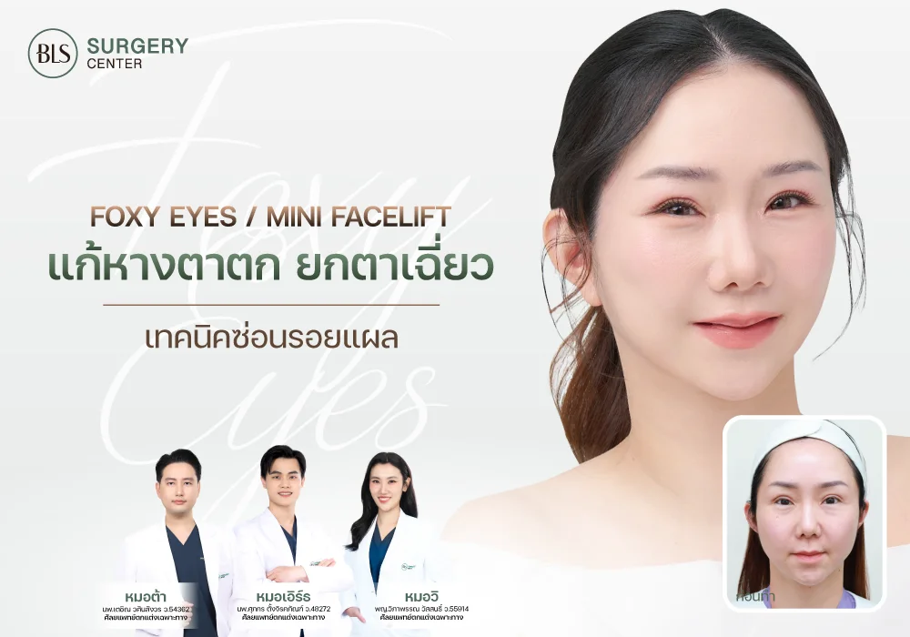 Foxy Eyes แก้หางตาตก ยกหางตาเฉี่ยว