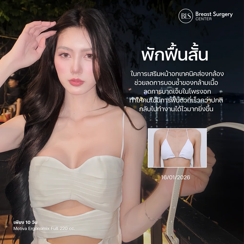 หลังเสริมหน้าอกพักกี่วัน
