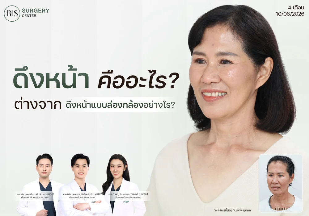 ดึงหน้า คืออะไร? ต่างจากดึงหน้าแบบส่องกล้องอย่างไร?