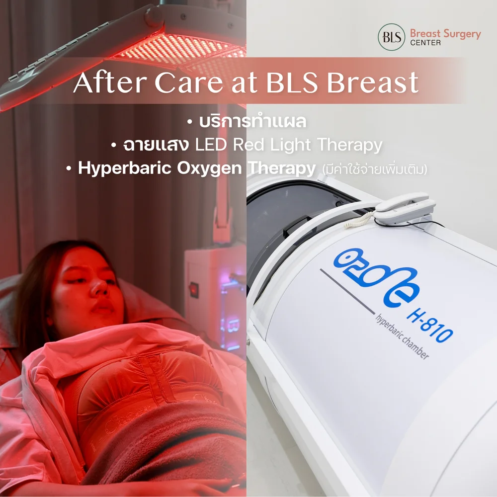 ดูแลหลังเสริมหน้าอก ด้วย After Care at BLS Breast