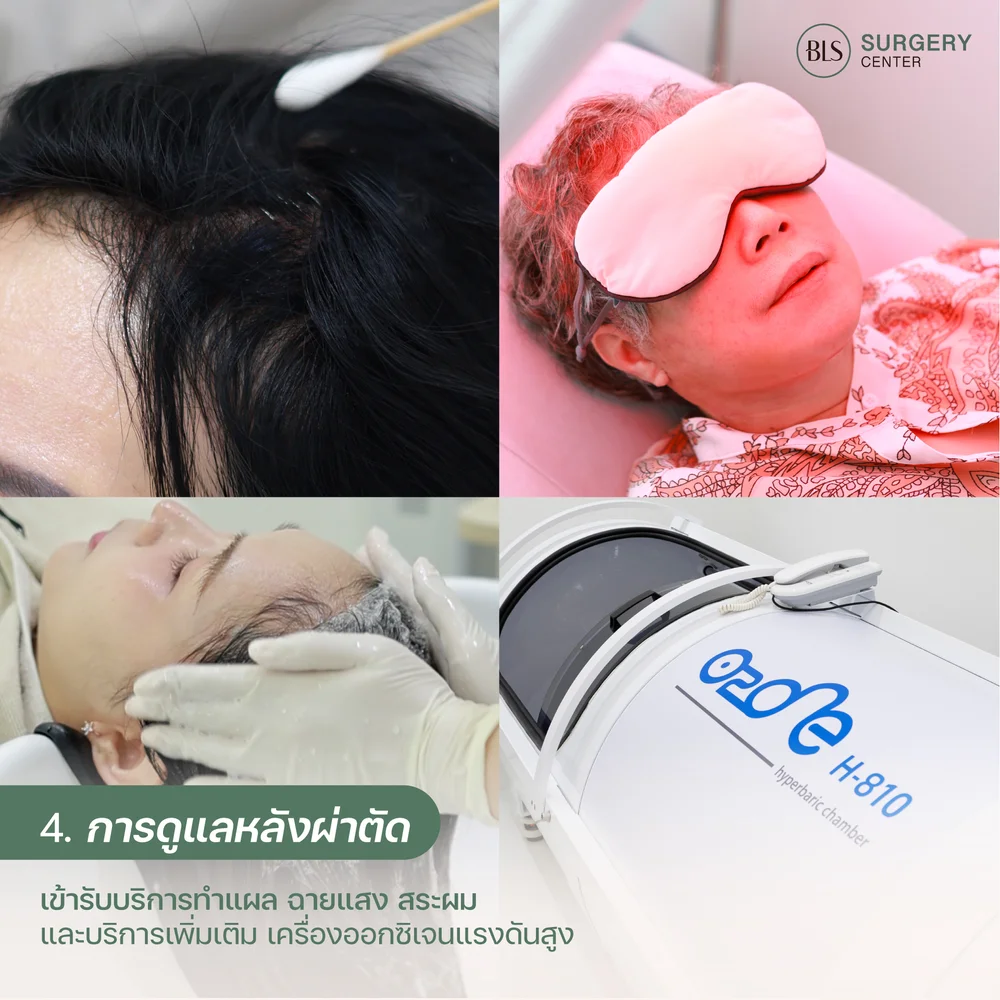 บริการ Aftercare หลังทำ Facelift & Necklift