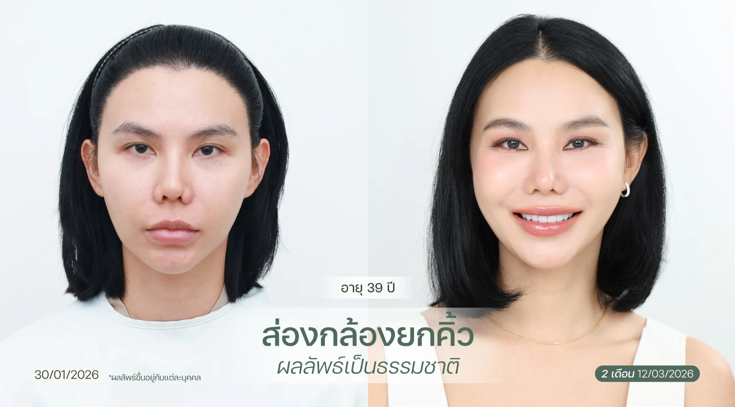 BA-web-Kทิพย์