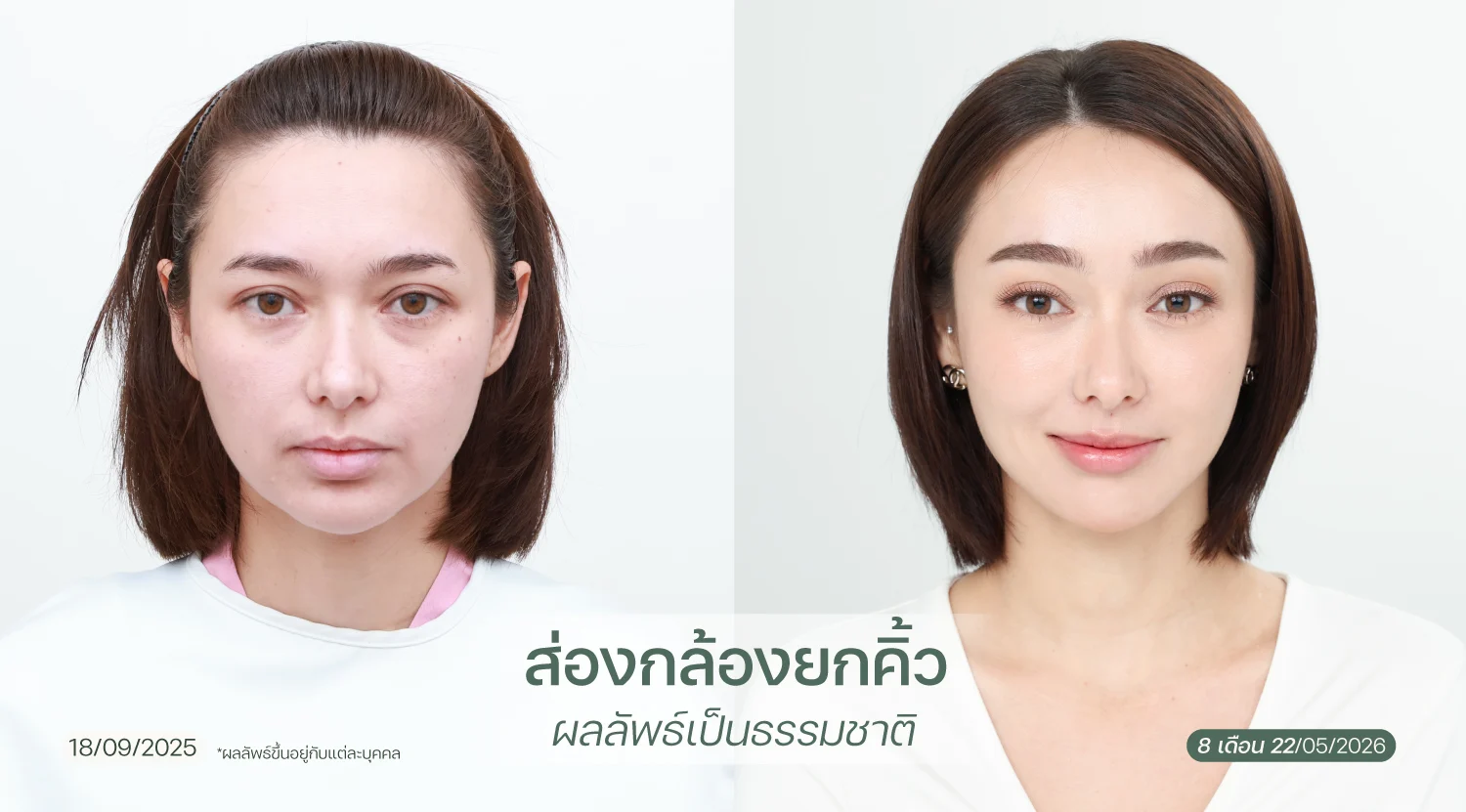 BA-web-Kมิกกี้