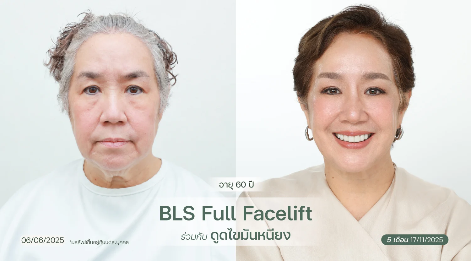 BA-web-Kแม่ตั้ม