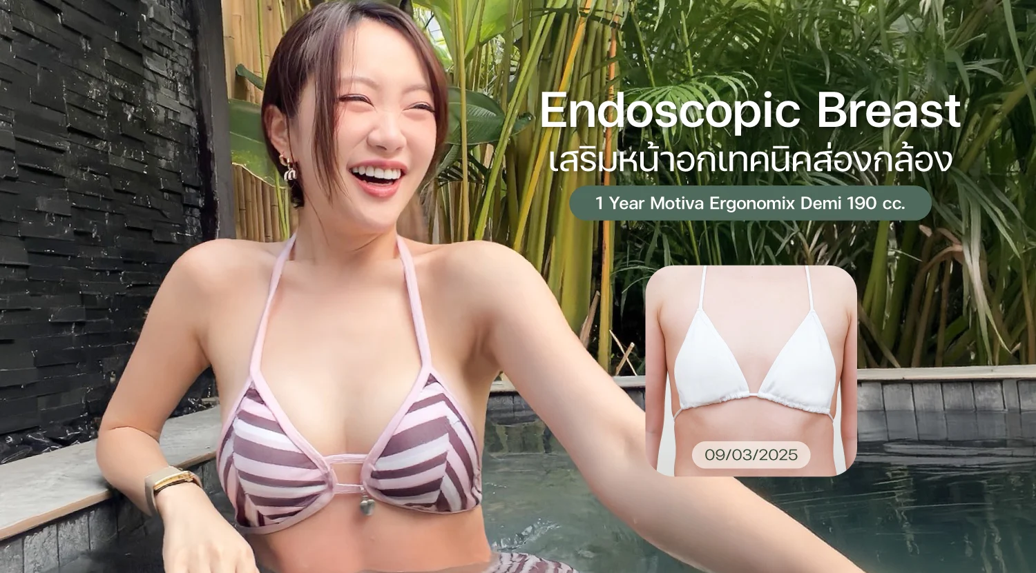 Breast-0
