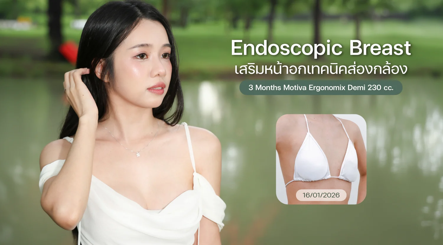 Breast-01
