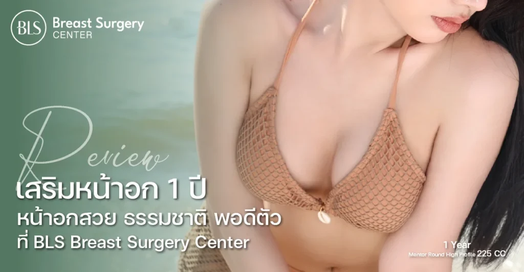 รีวิวเสริมหน้าอก 1 ปี หน้าอกสวย ธรรมชาติ พอดีตัว
ที่ BLS Breast Surgery Center