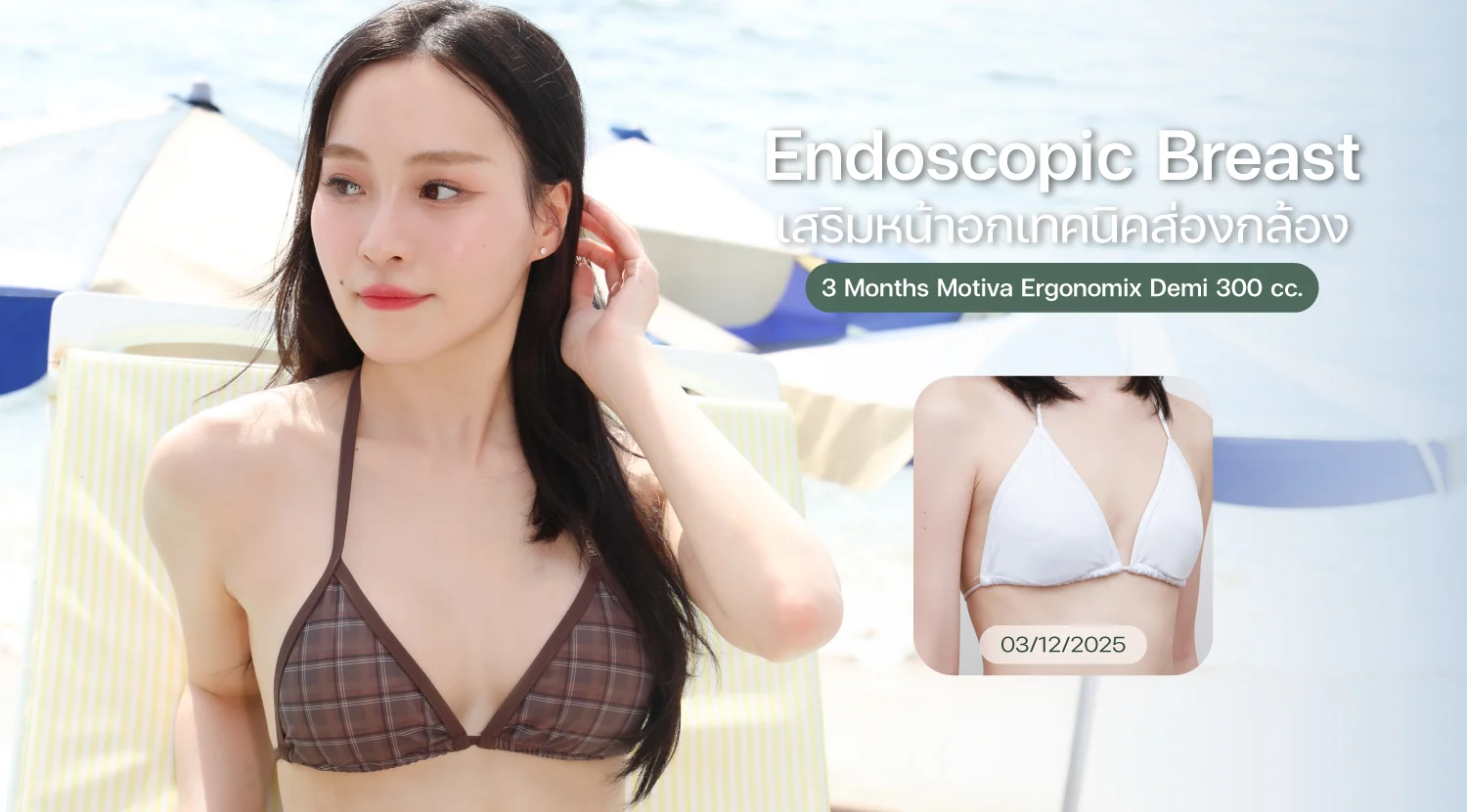 Breast-ยูโร++