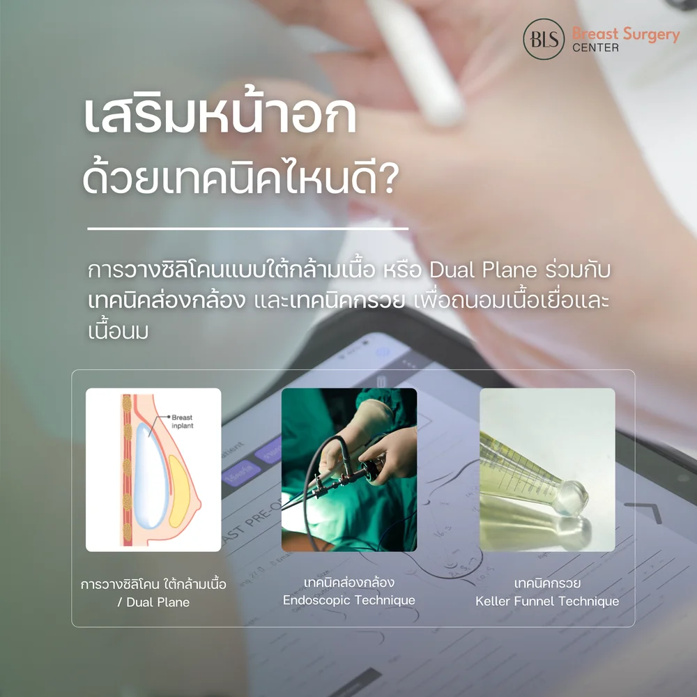 เสริมหน้าอกเทคนิกส่องกล้อง