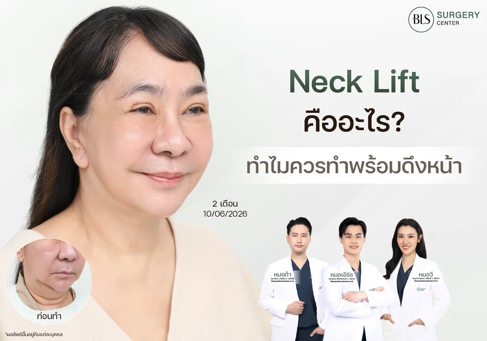 Necklift คืออะไร? ทำไมควรทำพร้อมดึงหน้า? ไขข้อสงสัยก่อนตัดสินใจผ่าตัด