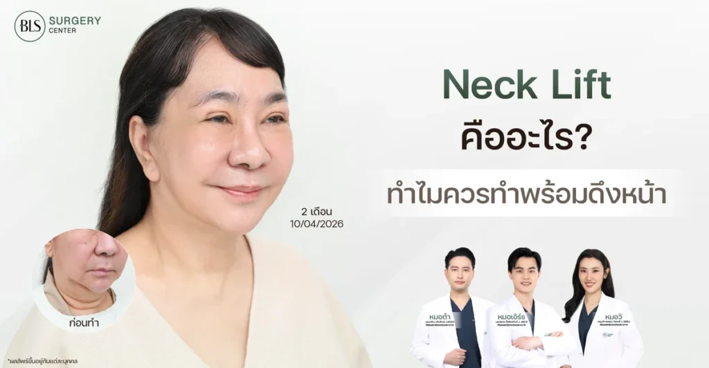 Necklift คืออะไร? ทำไมควรทำพร้อมดึงหน้า? ไขข้อสงสัยก่อนตัดสินใจผ่าตัด