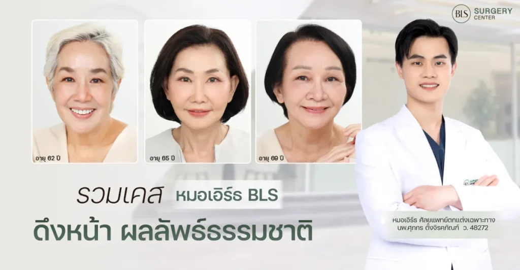 รวมเคสหมอเอิร์ธ ดึงหน้า ผลลัพธ์ธรรมชาติ ดูสดใสขึ้นแบบยังเป็นตัวเอง