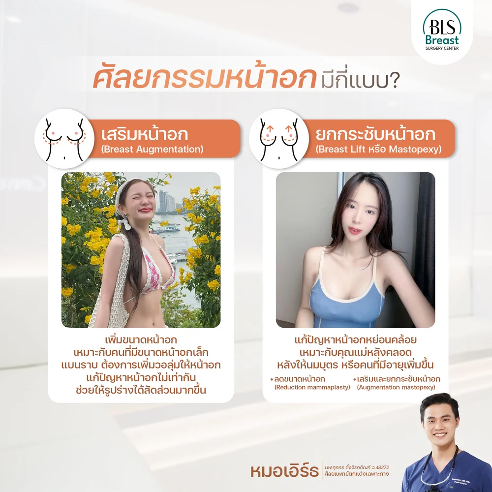 ตารางเปรียบเทียบเสริมหน้าอกกับยกกระชับหน้าอก