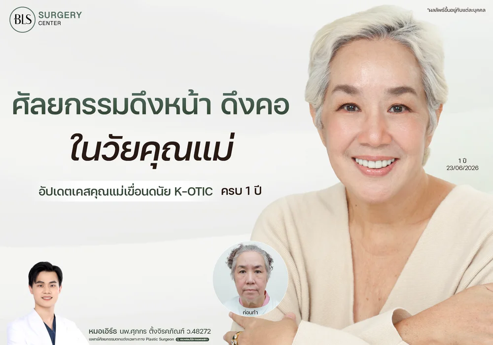 ศัลยกรรมดึงหน้า ดึงคอ ในวัยคุณแม่ อัปเดตเคสคุณแม่เขื่อนดนัย K-OTIC ครบ 1 ปี
