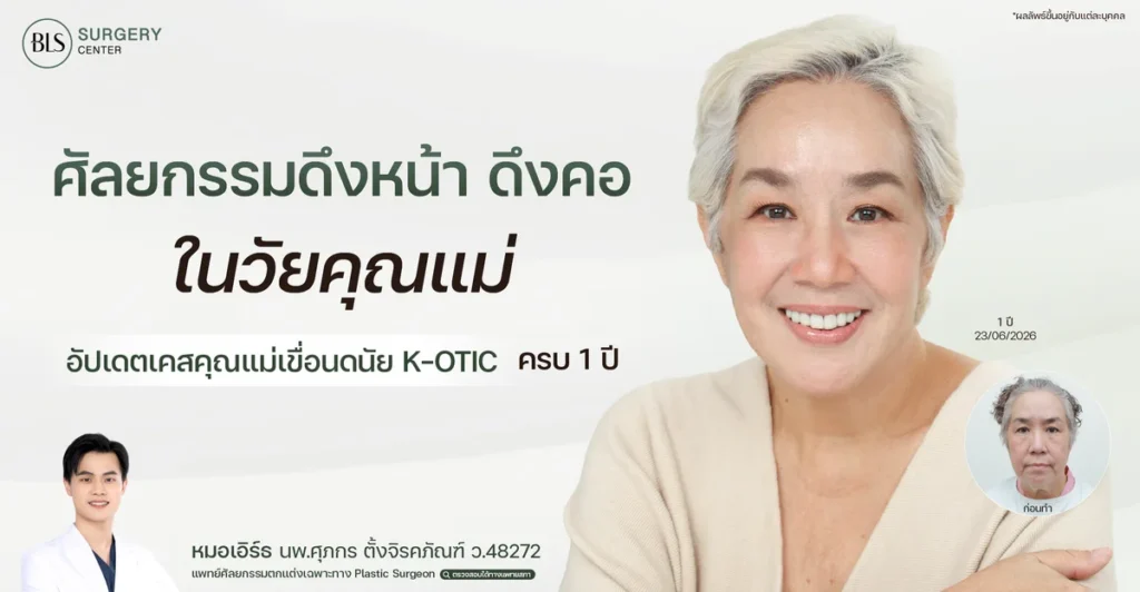 ศัลยกรรมดึงหน้า ดึงคอ ในวัยคุณแม่ อัปเดตเคสคุณแม่เขื่อนดนัย K-OTIC ครบ 1 ปี
