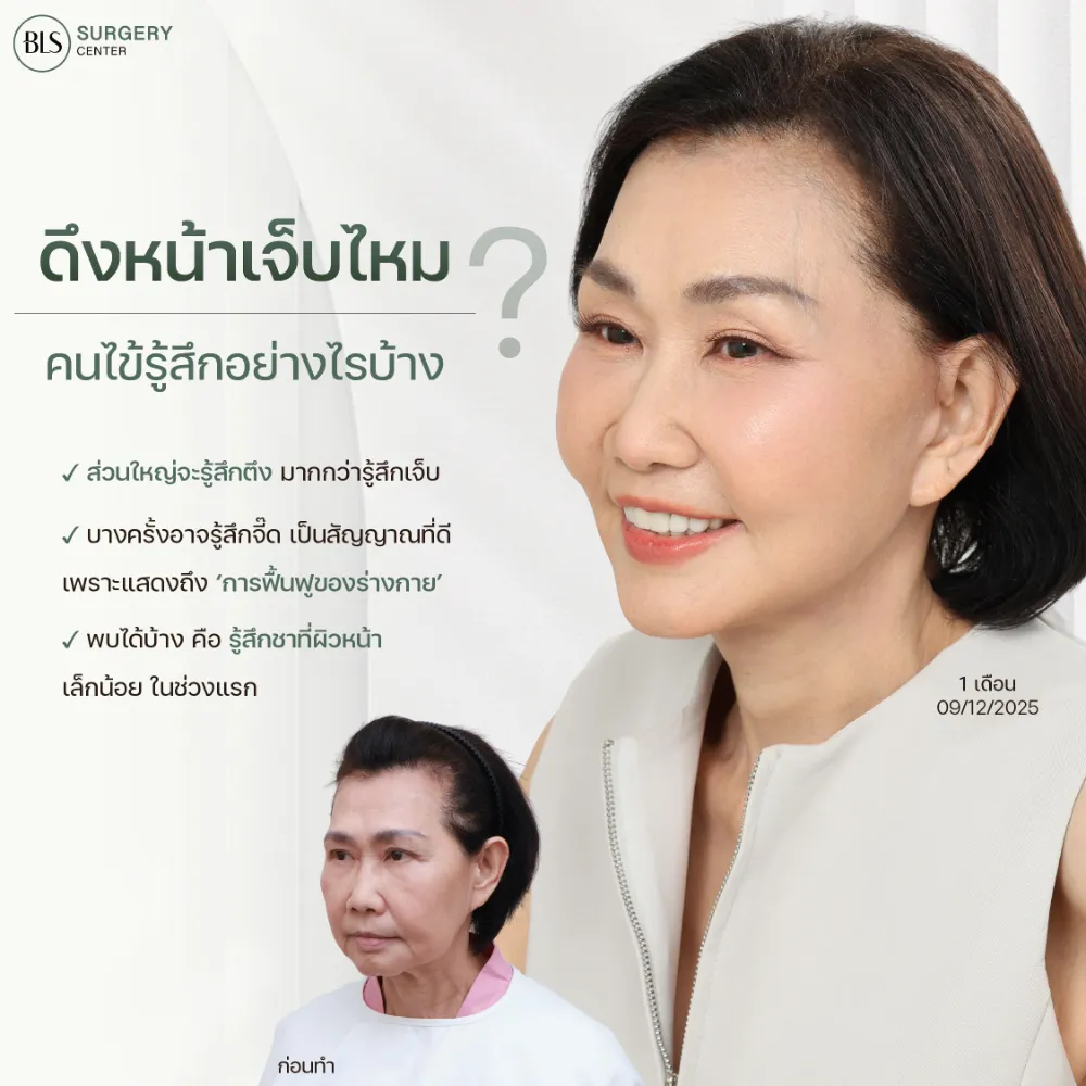 ดึงหน้าเจ็บไหม คนไข้รู้สึกอย่างไรบ้าง