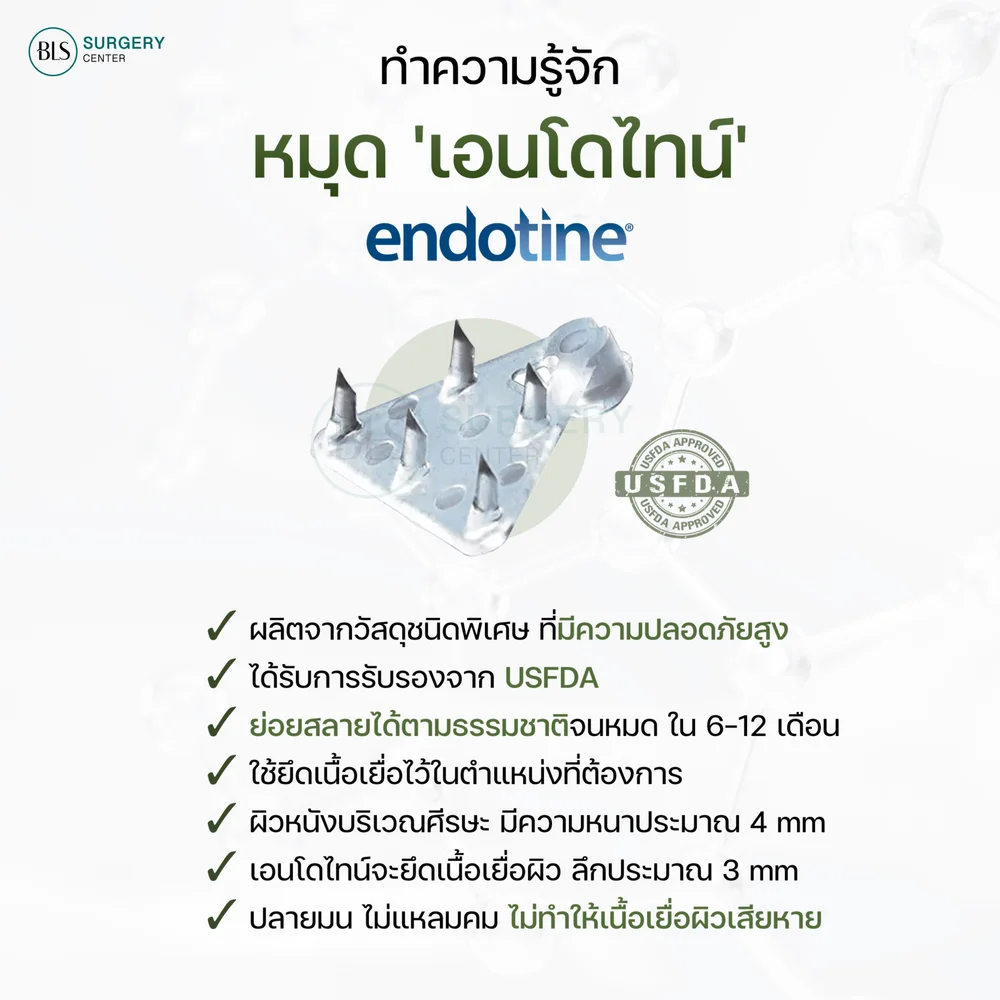 Endotine คืออะไร? มีลักษณะอย่างไร