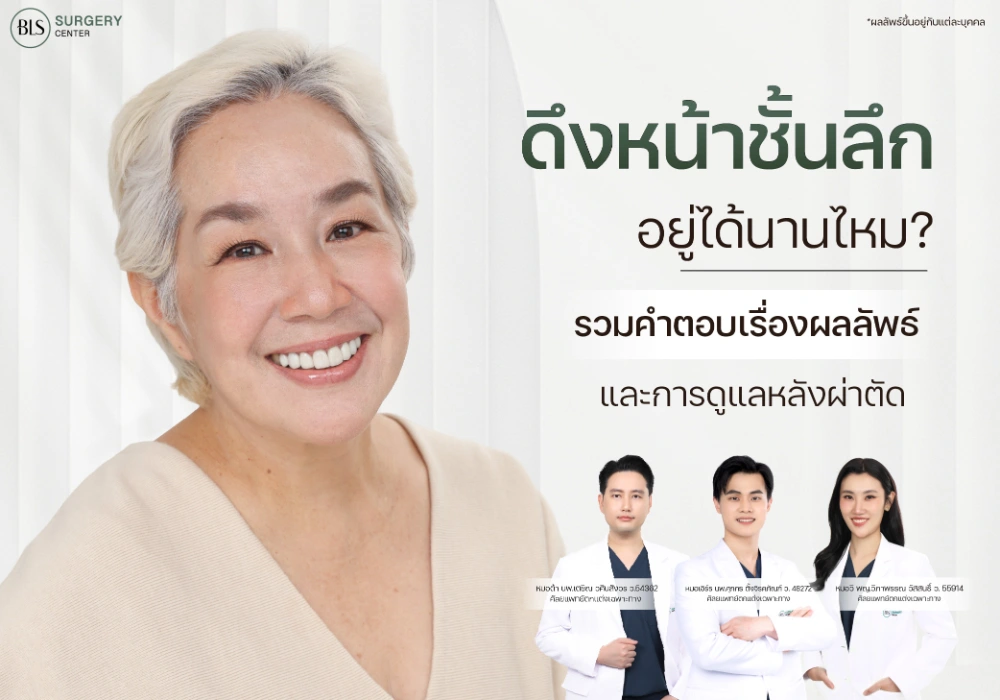 ดึงหน้าชั้นลึกอยู่ได้นานไหม? รวมคำตอบเรื่องผลลัพธ์ และการดูแลหลังผ่าตัด
