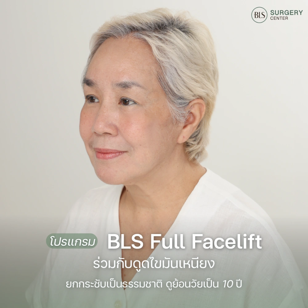ดึงหน้าชั้นลึกอยู่ได้นานไหม ผลลัพธ์ Deep SMAS Facelift และการดูแลหลังผ่าตัด