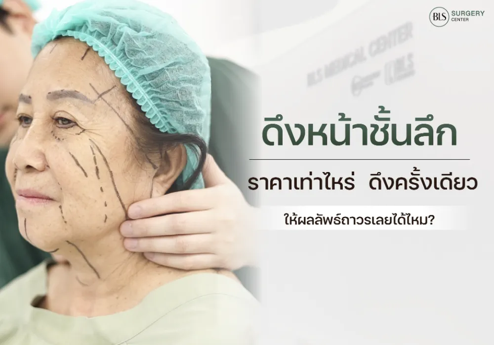 ดึงหน้าชั้นลึก ราคาเท่าไหร่ ดึงครั้งเดียว ให้ผลลัพธ์ถาวรหรือไม่?