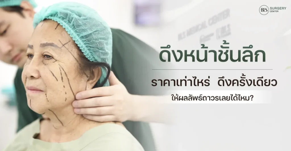 ดึงหน้าชั้นลึก ราคาเท่าไหร่ ดึงครั้งเดียว ให้ผลลัพธ์ถาวรหรือไม่?