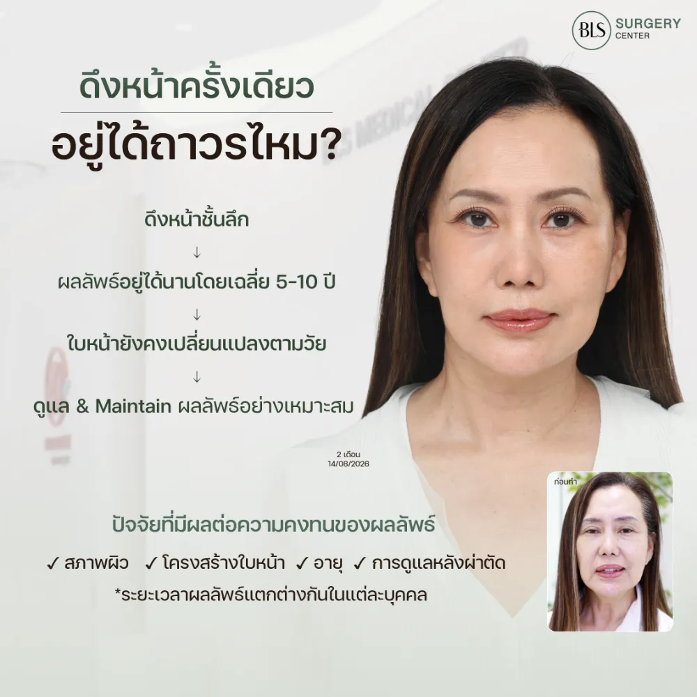 ดึงหน้าชั้นลึก ถาวรไหม ดึงหน้าครั้งเดียวอยู่ได้กี่ปี