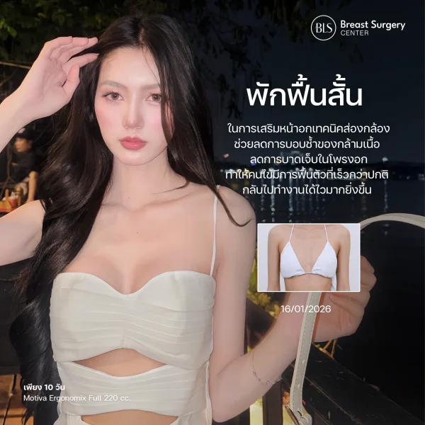 How many days of recovery are needed after breast augmentation